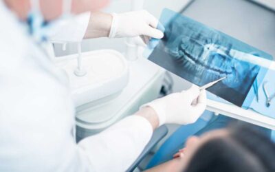 How Much Does Wisdom Teeth Removal Cost in Oakville?
